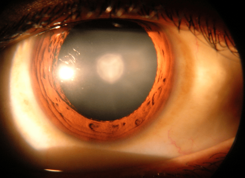 Eye Problems for Dogs 1 Cataracts are acommon doy eye problems.